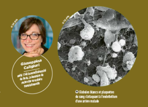 'Têtes chercheuses' in the INSERM Magazine: highlight on G Caligiuri's work